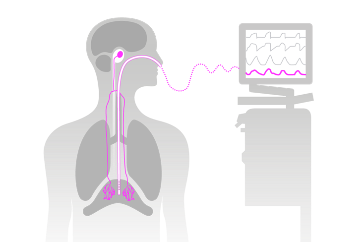 Diagram of a human silhouette showing a tube connected from the nose to a monitor, indicating internal monitoring.